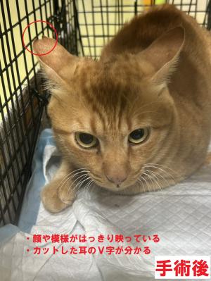 手術後写真1(例)