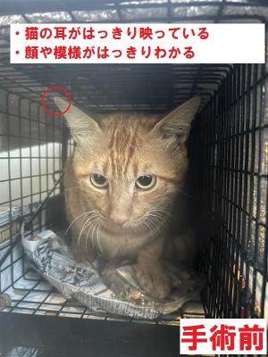 手術前写真1(例)